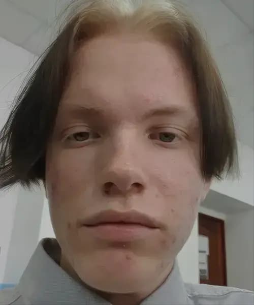 Before transformation